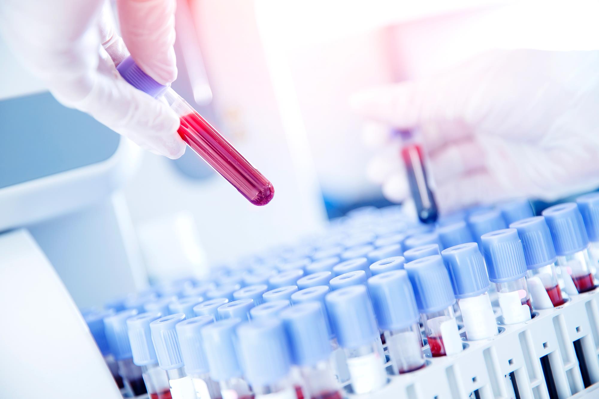 Understanding Peptide Synthesis: Innovations and Best Practices